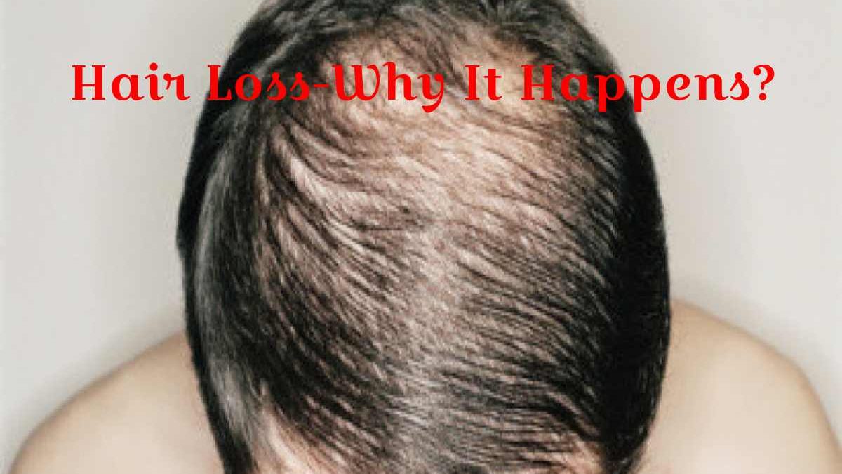 Hair Loss-Why It Happens?