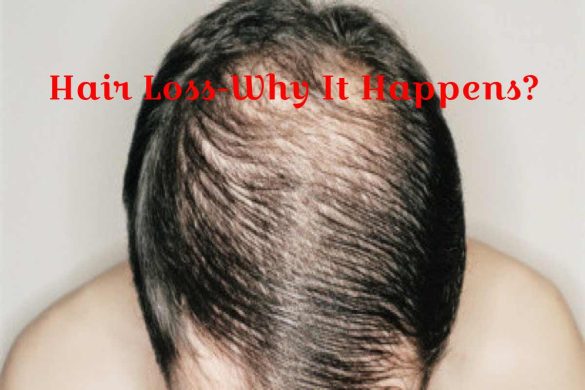 Hair Loss-Why It Happens_